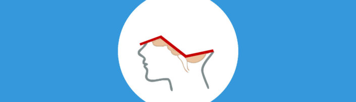 une-anencephalie